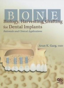 Bone Biology, Harvesting and Grafting for Dental Implants