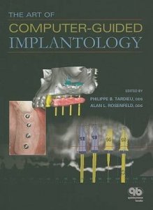 The Art of Computer-guided Implantology