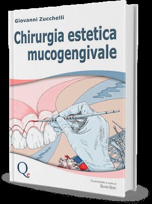 Chirurgia estetica mucogengivale