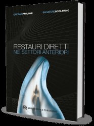 Restauri diretti nei settori anteriori
