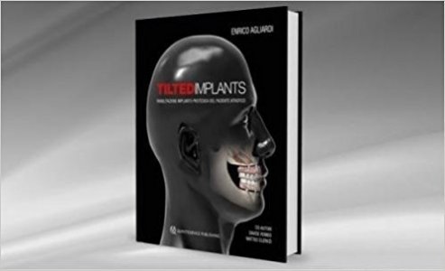 Tilted implants. Riabilitazione implanto-protesica del paziente atrofico