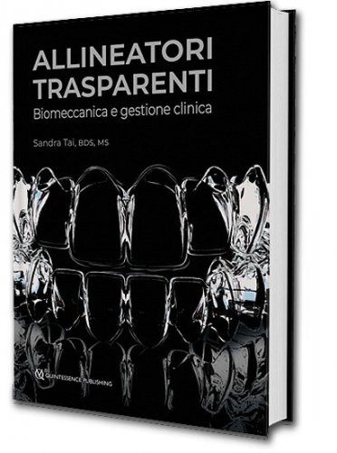 Allineatori trasparenti. Biomeccanica e gestione clinica