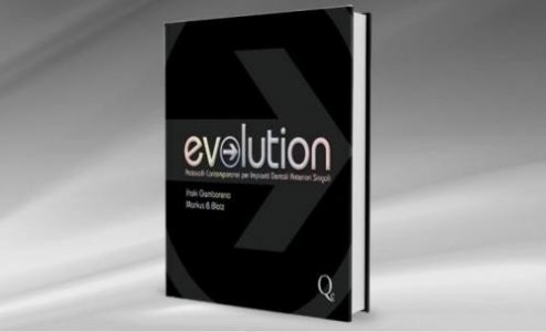 Evolution. Protocolli contemporanei per impianti dentali anteriori singoli