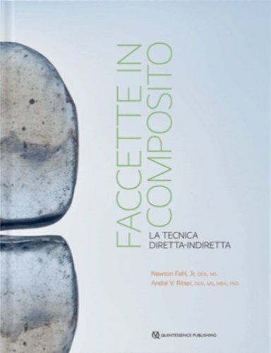 Faccette in composito. La tecnica diretta-indiretta
