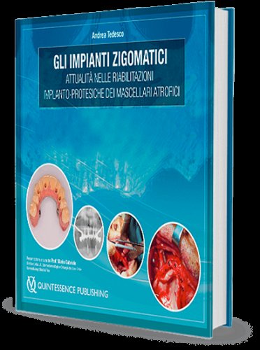 Gli impianti zigomatici. Attualità nelle riabilitazioni implanto-protesiche dei mascellari atrofici