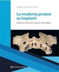 La moderna protesi su impianti. Guida la successo clinico sostenibile