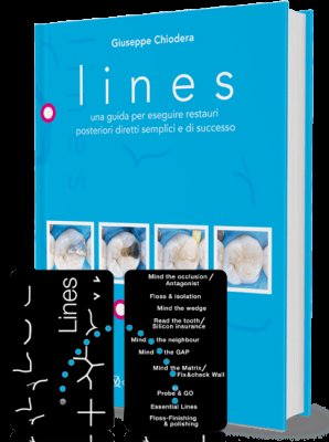 Lines. Una guida per eseguire restauri posteriori diretti semplici e di successo