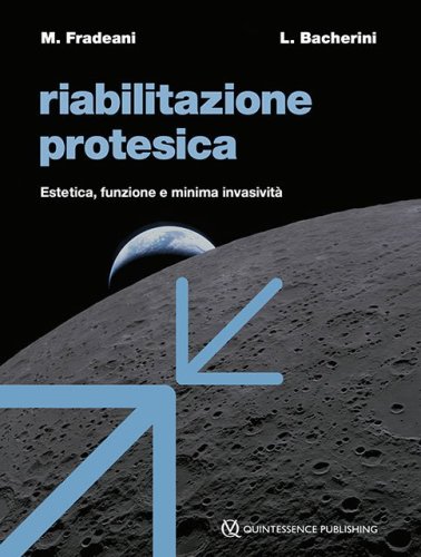 Riabilitazione protesica