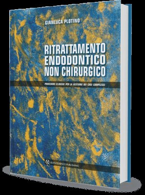 Ritrattamento endodontico non chirurgico. Procedure cliniche per la gestione dei casi complessi