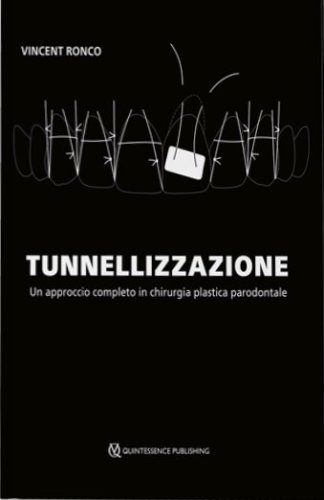 Tunnellizzazione