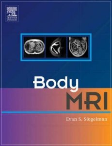 Body MRI