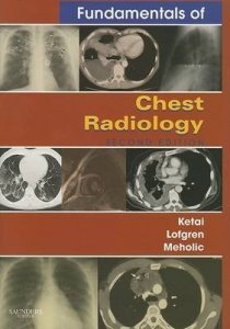 Fundamentals of Chest Radiology