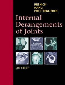 Internal Derangements of Joints