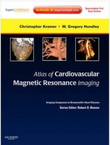 Atlas of Cardiovascular Magnetic Resonance Imaging