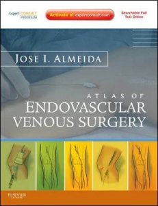 Atlas of Endovascular Venous Surgery