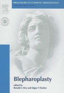 Blepharoplasty