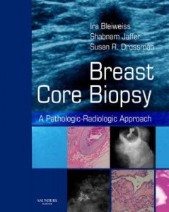 Breast Core Biopsy