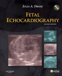 Fetal Echocardiography
