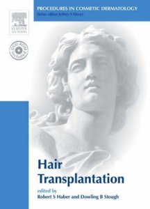 Hair Transplantation