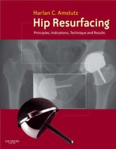 Hip Resurfacing