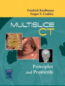 Multislice CT