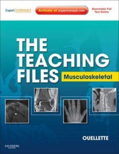 Musculoskeletal