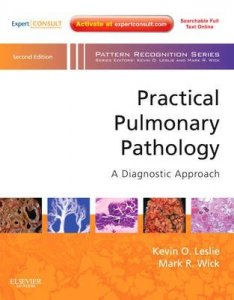 Practical Pulmonary Pathology: A Diagnostic Approach