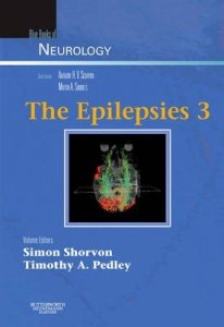 The Epilepsies
