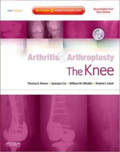 The Knee