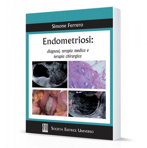 Endometriosi: diagnosi, terapia medica e terapia chirurgica