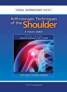Arthroscopic Techniques of the Shoulder