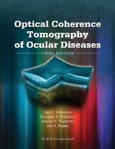 Optical Coherence Tomography of Ocular Diseases