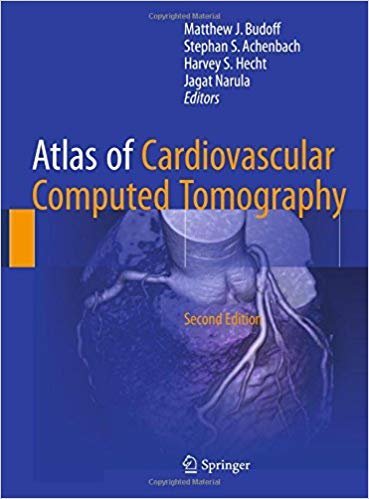 Atlas of Cardiovascular Computed Tomography