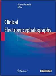 Clinical Electroencephalography