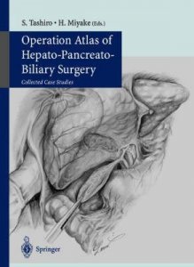 Operation Atlas of Hepato-pancreato-biliary Surgery