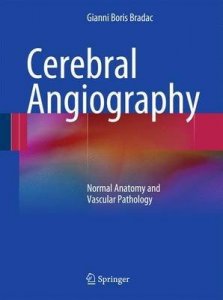Cerebral Angiography