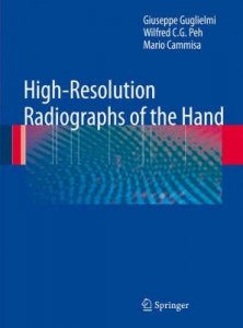 High-resolution Radiographs of the Hand