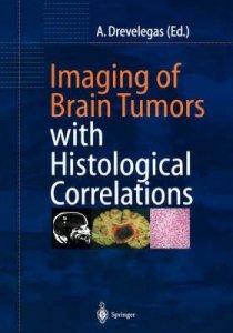 Imaging of Brain Tumors with Histological Correlations
