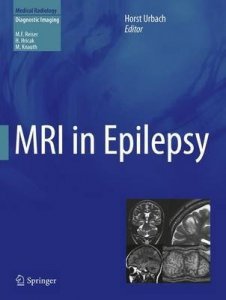 MRI in Epilepsy