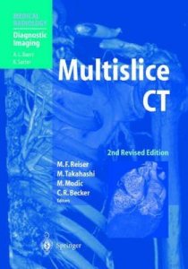 Multislice CT