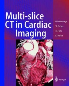 Multislice CT in Cardiac Imaging