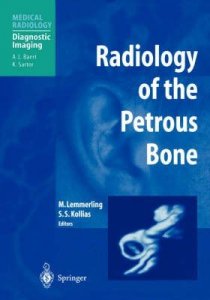 Radiology of the Petrous Bone