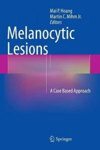 Melanocytic Lesions
