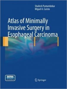 Atlas of Minimally Invasive Surgery in Esophageal Carcinoma