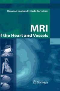 MRI of the heart and vessels