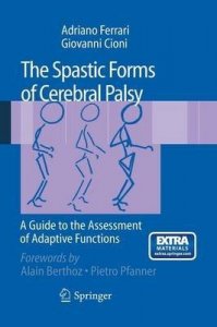 The Spastic Forms of Cerebral Palsy