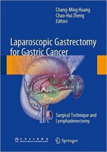 Laparoscopic Gastrectomy for Gastric Cancer