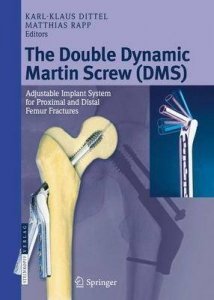 Double Dynamic Martin Srew (DMS)