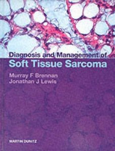 Diagnosis and Management of Soft Tissue Sarcoma