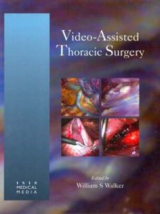 Video Assisted Thoracic Surgery